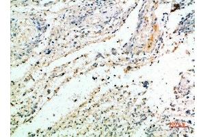Immunohistochemical analysis of paraffin-embedded human-brain, antibody was diluted at 1:200 (Versican 抗体  (AA 2530-2580))