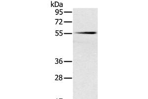 Western Blot analysis of Mouse pancreas tissue using SLC16A10 Polyclonal Antibody at dilution of 1:200 (SLC16A10 抗体)