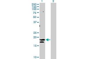 Western Blot analysis of ST6GAL1 expression in transfected 293T cell line by ST6GAL1 MaxPab polyclonal antibody. (ST6GAL1 抗体  (AA 1-175))