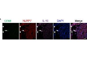 NLRP7 is predominantly expressed in decidual M2 macrophages (CD68+/IL-10+) in the human endometrium of the pregnant uterus. (IL-10 抗体  (AA 101-178))