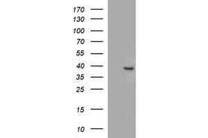 Image no. 1 for anti-Fatty Acid 2-Hydroxylase (FA2H) antibody (ABIN1500828) (FA2H 抗体)