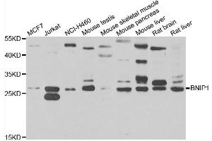 Western blot analysis of extracts of various cell lines, using BNIP1 antibody. (BNIP1 抗体)