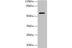 Western blot All lanes: GK3P antibody at 2 μg/mL + Hela whole cell lysate Secondary Goat polyclonal to rabbit IgG at 1/10000 dilution Predicted band size: 61 kDa Observed band size: 61 kDa (GK3P 抗体  (AA 1-220))