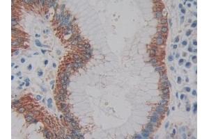 Immunohistochemistry (IHC) image for anti-Interleukin 2 (IL2) (AA 21-153) antibody (ABIN7428635)