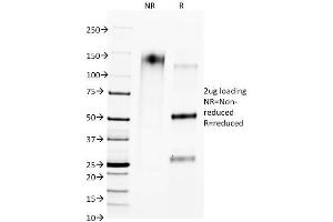 SDS-PAGE Analysis of Purified CTLA4 Mouse Monoclonal Antibody (L4P2F5. (CTLA4 抗体)