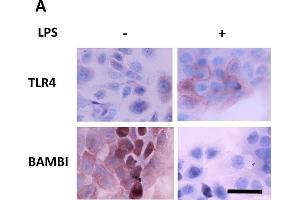 Immunocytochemistry (ICC) image for anti-BMP and Activin Membrane-Bound Inhibitor Homolog (BAMBI) (AA 101-200) antibody (ABIN1714490)