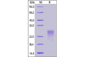 SDS-PAGE (SDS) image for Poliovirus Receptor-Related Immunoglobulin Domain Containing (PVRIG) (AA 41-171) (Active) protein (His tag,AVI tag,Biotin) (ABIN6973210)