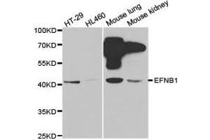 Western Blotting (WB) image for anti-Ephrin B1 (EFNB1) antibody (ABIN1872442) (Ephrin B1 抗体)
