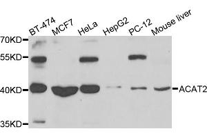 Western blot analysis of extracts of various cell lines, using ACAT2 antibody (ABIN5975212) at 1/1000 dilution. (ACAT2 抗体)