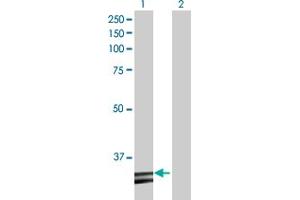 Western Blot analysis of HADH expression in transfected 293T cell line by HADH MaxPab polyclonal antibody. (HADH 抗体  (AA 1-314))