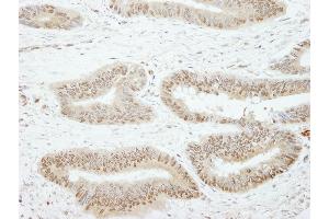 Immunohistochemistry (IHC) image for anti-Slingshot Homolog 3 (SSH3) (AA 609-659) antibody (ABIN7448817)