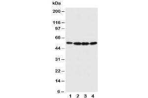 Western blot testing of Fascin antibody and Lane 1:  U87 (Fascin 抗体  (N-Term))