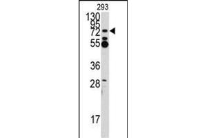 Western Blotting (WB) image for anti-Zinc Finger Protein 219 (ZNF219) (AA 154-183), (N-Term) antibody (ABIN388709)