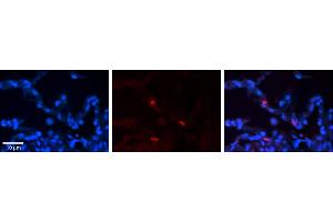 Rabbit Anti-FCGRT Antibody     Formalin Fixed Paraffin Embedded Tissue: Human Lung Tissue  Observed Staining: Membrane and cytoplasmic in alveolar type I cells  Primary Antibody Concentration: 1:100  Other Working Concentrations: 1/600  Secondary Antibody: Donkey anti-Rabbit-Cy3  Secondary Antibody Concentration: 1:200  Magnification: 20X  Exposure Time: 0. (FcRn 抗体  (N-Term))