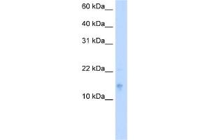 WB Suggested Anti-VAMP5 Antibody Titration:  5.