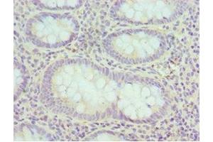 Immunohistochemistry of paraffin-embedded human epityphlon tissue using ABIN7152160 at dilution of 1:100 (EIF3H 抗体  (AA 80-340))