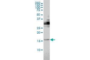 TRAPPC2 monoclonal antibody (M01), clone 2E10 Western Blot analysis of TRAPPC2 expression in Hela . (TRAPPC2 抗体  (AA 1-140))