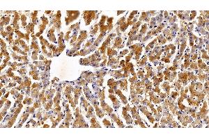 Immunohistochemistry (IHC) image for anti-Signal Transducer and Activator of Transcription 3 (Acute-Phase Response Factor) (STAT3) (AA 563-670) antibody (ABIN7437089)