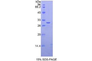 SDS-PAGE analysis of Human GLI3 Protein. (GLI Family Zinc Finger Protein 3 蛋白)
