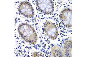 Immunohistochemistry of paraffin-embedded human colon using GTF2F2 antibody (ABIN6131726, ABIN6141494, ABIN6141496 and ABIN6217519) at dilution of 1:200 (40x lens). (GTF2F2 抗体  (AA 1-249))