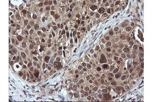 Image no. 8 for anti-Leucine Zipper and CTNNBIP1 Domain Containing (LZIC) antibody (ABIN1499239)