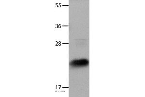 Western blot analysis of Hela cells, using IL18 Polyclonal Antibody at dilution of 1:1350 (IL-18 抗体)