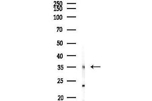 anti-Chromosome 7 Open Reading Frame 20 (C7orf20) antibody
