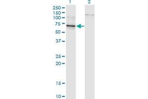 Western Blot analysis of TBX22 expression in transfected 293T cell line by TBX22 monoclonal antibody (M01), clone 1A10.