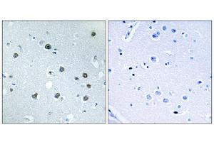 Immunohistochemistry analysis of paraffin-embedded human brain tissue using MYO1D antibody. (Myosin ID 抗体  (C-Term))