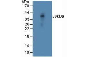 Detection of NOTCH4 in Rat Vein Tissue using Polyclonal Antibody to Notch Homolog 4 (NOTCH4) (NOTCH4 抗体  (AA 1715-2001))