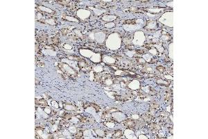 IHC analysis of mSin3A/SIN3A using anti-mSin3A/SIN3A antibody (ABIN7602504). (SIN3A 抗体  (AA 8-918))