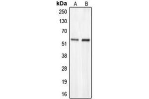 Western blot analysis of CHST2 expression in HepG2 (A), COLO205 (B) whole cell lysates. (CHST2 抗体  (N-Term))