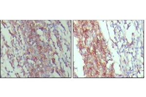 Immunohistochemical analysis of paraffin-embedded human lymph node tissue,showing membrane and cytoplasmic localization with DAB staining using CD45 mouse mAb. (CD45 抗体)