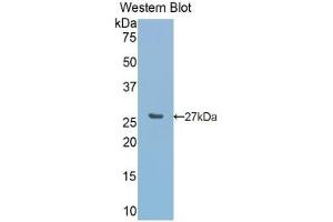 Detection of recombinant CA5A using Polyclonal Antibody to Carbonic Anhydrase VA (CA5A) (CA5A 抗体  (AA 12-219))