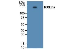 Detection of ACE in Human Lung Tissue using Polyclonal Antibody to Angiotensin I Converting Enzyme (ACE) (Angiotensin I Converting Enzyme 1 抗体  (AA 814-1071))