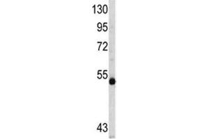 Western blot analysis of MYCN antibody and CEM lysate (MYCN 抗体  (AA 322-351))