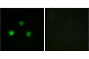 Immunofluorescence analysis of HuvEc cells, using MSH2 Antibody.