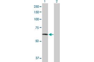 Western Blot analysis of FGFR1 expression in transfected 293T cell line by FGFR1 MaxPab polyclonal antibody. (FGFR1 抗体  (AA 1-731))
