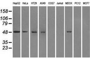 Western blot analysis of extracts (35 µg) from 9 different cell lines by using anti-FH monoclonal antibody. (FH 抗体)