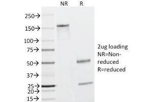 SDS-PAGE Analysis Purified Caldesmon Mouse Monoclonal Antibody (h-CALD). (Caldesmon 抗体)