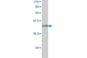 Western Blot detection against Immunogen (37. (VAV1 抗体  (AA 681-790))