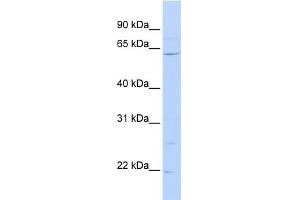 WB Suggested Anti-ZNF680 Antibody Titration:  0. (ZNF680 抗体  (N-Term))