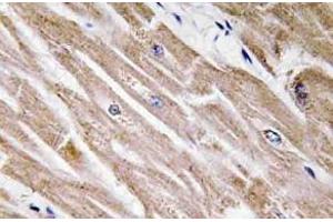 Immunohistochemistry analysis of BMP-5 Antibody in paraffin-embedded human heart tissue. (BMP5 抗体)