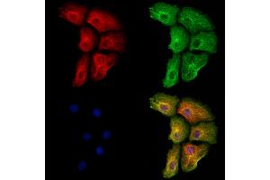 ABIN6264651 and ABIN6273154 staining Hela cells by IF/ICC.