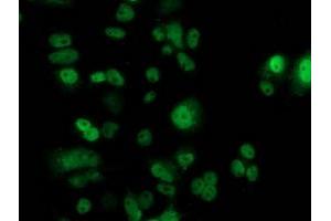 Immunofluorescence (IF) image for anti-Tumor Protein P53 (TP53) antibody (ABIN1499968) (p53 抗体)