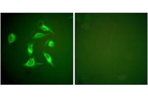 Immunofluorescence analysis of HeLa cells, using PDGFR alpha Antibody. (PDGFRA 抗体  (AA 1031-1080))