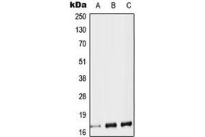 Western blot analysis of Protachykinin 1 expression in HEK293T (A), SP2/0 (B), H9C2 (C) whole cell lysates. (TAC1 抗体  (Center))