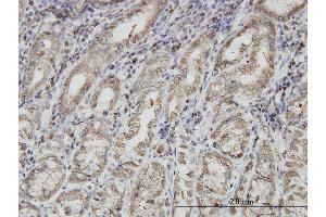 Immunoperoxidase of monoclonal antibody to PNMA1 on formalin-fixed paraffin-embedded human stomach. (PNMA1 抗体  (AA 62-160))