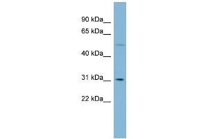 WB Suggested Anti-MRPL28 Antibody Titration: 0. (MRPL28 抗体  (Middle Region))