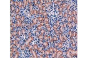 Used in DAB staining on fromalin fixed paraffin-embedded Liver tissue (Galanin 抗体  (AA 36-123))